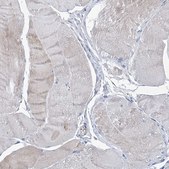 Anti-FPR2 antibody produced in rabbit Prestige Antibodies&#174; Powered by Atlas Antibodies, affinity isolated antibody, buffered aqueous glycerol solution