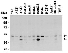 Anti-DR5 Antibody, CT Chemicon&#174;, from rabbit