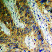 Anti-phospho-Adrenergic Receptor B2 (pSer355+Ser356) antibody produced in rabbit affinity isolated antibody