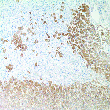 Inhibin, alpha (R1) Mouse Monoclonal Antibody