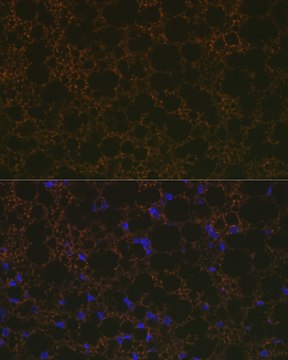 Anti-UCP1+UCP3 Antibody, clone 0S10O10, Rabbit Monoclonal