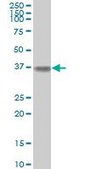 Monoclonal Anti-ALDOA antibody produced in mouse clone 3D9-6F3, purified immunoglobulin, buffered aqueous solution