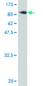 Monoclonal Anti-LIMK2 antibody produced in mouse clone 2H2-E11, purified immunoglobulin, buffered aqueous solution