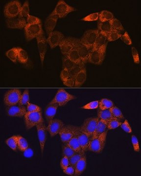 Anti-GOT1 antibody produced in rabbit