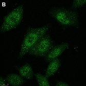 Anti-HDAC4 Antibody, clone 1C16 ZooMAb® Rabbit Monoclonal recombinant, expressed in HEK 293 cells