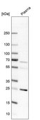 Anti-EDN1 antibody produced in rabbit Prestige Antibodies&#174; Powered by Atlas Antibodies, affinity isolated antibody, buffered aqueous glycerol solution