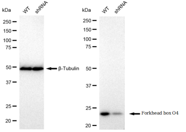 KD-Validated Anti Forkhead box O4 Antibody, clone 23GB1470, Rabbit Monoclonal clone 23GB1470, recombinant rabbit monoclonal, expressed in HEK293 cells