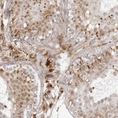 Anti-TCTEX1D1 antibody produced in rabbit Prestige Antibodies&#174; Powered by Atlas Antibodies, affinity isolated antibody, buffered aqueous glycerol solution