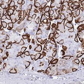 Anti-AQP4 antibody produced in rabbit affinity isolated antibody, Prestige Antibodies&#174; Powered by Atlas Antibodies, buffered aqueous glycerol solution