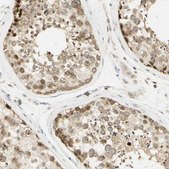 Anti-KIF11 antibody produced in rabbit Prestige Antibodies® Powered by Atlas Antibodies, affinity isolated antibody, buffered aqueous glycerol solution