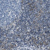 Anti-NLRP3 antibody produced in rabbit Prestige Antibodies&#174; Powered by Atlas Antibodies, affinity isolated antibody, buffered aqueous glycerol solution