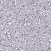 Anti-PRPH2 antibody produced in rabbit Prestige Antibodies&#174; Powered by Atlas Antibodies, affinity isolated antibody, buffered aqueous glycerol solution
