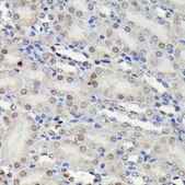 Anti-Phospho-JNK1/2/3-T183/T183/T221 antibody produced in rabbit
