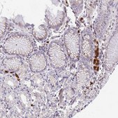 Anti-CSF3R antibody produced in rabbit Prestige Antibodies&#174; Powered by Atlas Antibodies, affinity isolated antibody, buffered aqueous glycerol solution