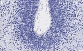 Anti-LMX-1 Antibody, clone 4L12, ZooMAb&#174; Rabbit Monoclonal recombinant, expressed in HEK 293 cells