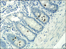 Anti-acetyl- &amp; phospho-Histone H3 (Ac-Lys9, pSer10) antibody produced in rabbit IgG fraction of antiserum, buffered aqueous solution