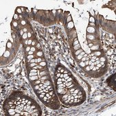 Anti-PSMB1 antibody produced in rabbit affinity isolated antibody, buffered aqueous glycerol solution, ab1