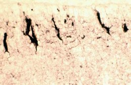 Anti-Reelin Antibody, a.a. 164-189 mreelin, clone 142 clone 142, Chemicon&#174;, from mouse