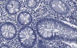 Anti-PML Antibody, clone 1F13 ZooMAb&#174; Rabbit Monoclonal recombinant, expressed in HEK 293 cells