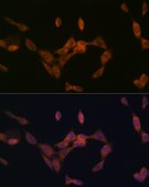 Anti-PMP70/ABCD3 Antibody, clone 3V4K3, Rabbit Monoclonal