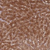 Anti-ADH1A antibody produced in rabbit Prestige Antibodies&#174; Powered by Atlas Antibodies, affinity isolated antibody, buffered aqueous glycerol solution
