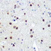 Anti-HES1 antibody produced in rabbit