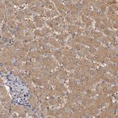 Anti-KCNJ8 antibody produced in rabbit Prestige Antibodies&#174; Powered by Atlas Antibodies, affinity isolated antibody, buffered aqueous glycerol solution