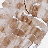 Anti-MYLK2 antibody produced in rabbit Prestige Antibodies&#174; Powered by Atlas Antibodies, affinity isolated antibody, buffered aqueous glycerol solution