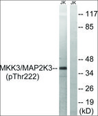 Anti-phospho-MAP2K3 (pThr222) antibody produced in rabbit affinity isolated antibody