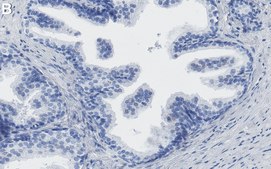 Anti-TIMP-1 Antibody, clone 1H19 ZooMAb&#174; Rabbit Monoclonal recombinant, expressed in HEK 293 cells