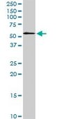 Monoclonal Anti-STK3 antibody produced in mouse clone 4F7, purified immunoglobulin, buffered aqueous solution