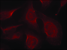 Anti-phospho-BCL2L11 (pSer69) antibody produced in rabbit affinity isolated antibody