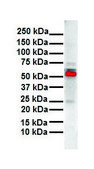 Anti-ESR2 antibody produced in rabbit affinity isolated antibody