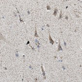 Anti-CAMKK2 antibody produced in rabbit Prestige Antibodies&#174; Powered by Atlas Antibodies, affinity isolated antibody, buffered aqueous glycerol solution