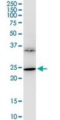 Monoclonal Anti-BDNF antibody produced in mouse clone 1B10, purified immunoglobulin, buffered aqueous solution