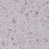 Anti-GFAP antibody produced in rabbit Prestige Antibodies&#174; Powered by Atlas Antibodies, affinity isolated antibody, buffered aqueous glycerol solution