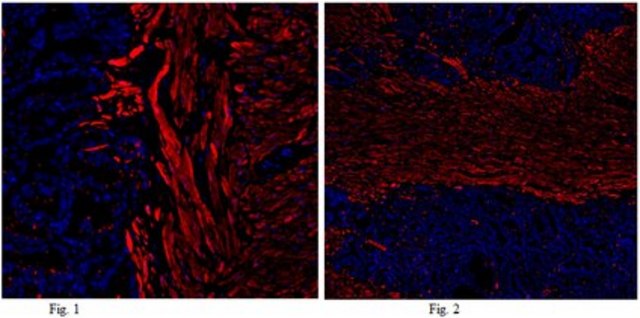 Anti-Calponin-1 Antibody from rabbit, purified by affinity chromatography