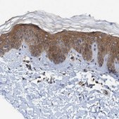 Anti-TRIM65 antibody produced in rabbit Prestige Antibodies&#174; Powered by Atlas Antibodies, affinity isolated antibody, buffered aqueous glycerol solution, Ab2