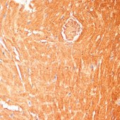 Anti-CPT1B antibody produced in rabbit