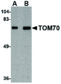 Anti-TOM70 antibody produced in rabbit affinity isolated antibody