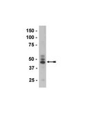 Anti-Tau (3-repeat isoform RD3) Antibody, clone 8E6/C11 culture supernatant, clone 8E6/C11, Upstate&#174;