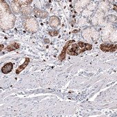 Anti-SLC18A2 antibody produced in mouse Prestige Antibodies&#174; Powered by Atlas Antibodies, clone CL12531, purified by using Protein A, buffered aqueous glycerol solution