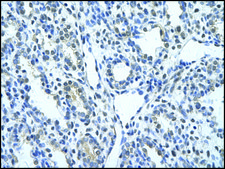 Anti-KRT17 antibody produced in rabbit affinity isolated antibody