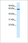 Anti-AMH affinity isolated antibody