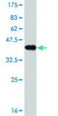 Monoclonal Anti-AFP antibody produced in mouse clone 1G7, purified immunoglobulin, buffered aqueous solution