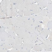 Anti-BBOX1 antibody produced in rabbit Prestige Antibodies&#174; Powered by Atlas Antibodies, affinity isolated antibody, buffered aqueous glycerol solution
