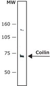 Anti-Coilin antibody, Mouse monoclonal ~1.5&#160;mg/mL, clone p&#948;, purified from hybridoma cell culture