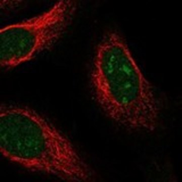 Anti-UCK1 antibody produced in rabbit Prestige Antibodies&#174; Powered by Atlas Antibodies, affinity isolated antibody, buffered aqueous glycerol solution