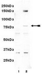 Anti-phospho-LIMK 1/2 (Tyr507/Thr508) Antibody Upstate&#174;, from rabbit