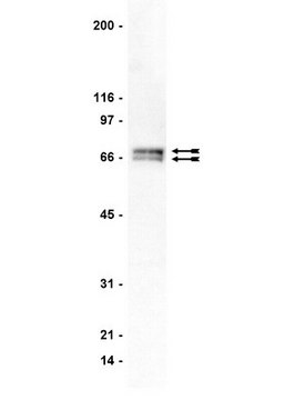 Anti-GRK 4-6 Antibody, clone A16/17 clone A16/17, Upstate&#174;, from mouse
